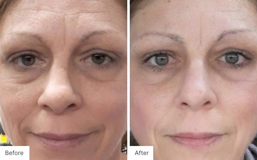 4 - Before and After Real Results image for Age IQ Night Cream